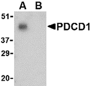 PDCD1 Antibody