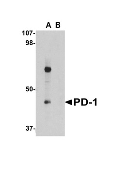 PD-1 Antibody