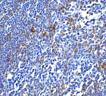 PD-1 Antibody