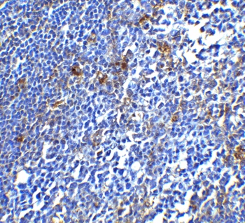 PDCD1 Antibody