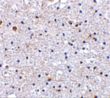 PDCD1 Antibody