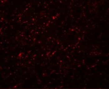 GRB10 Antibody