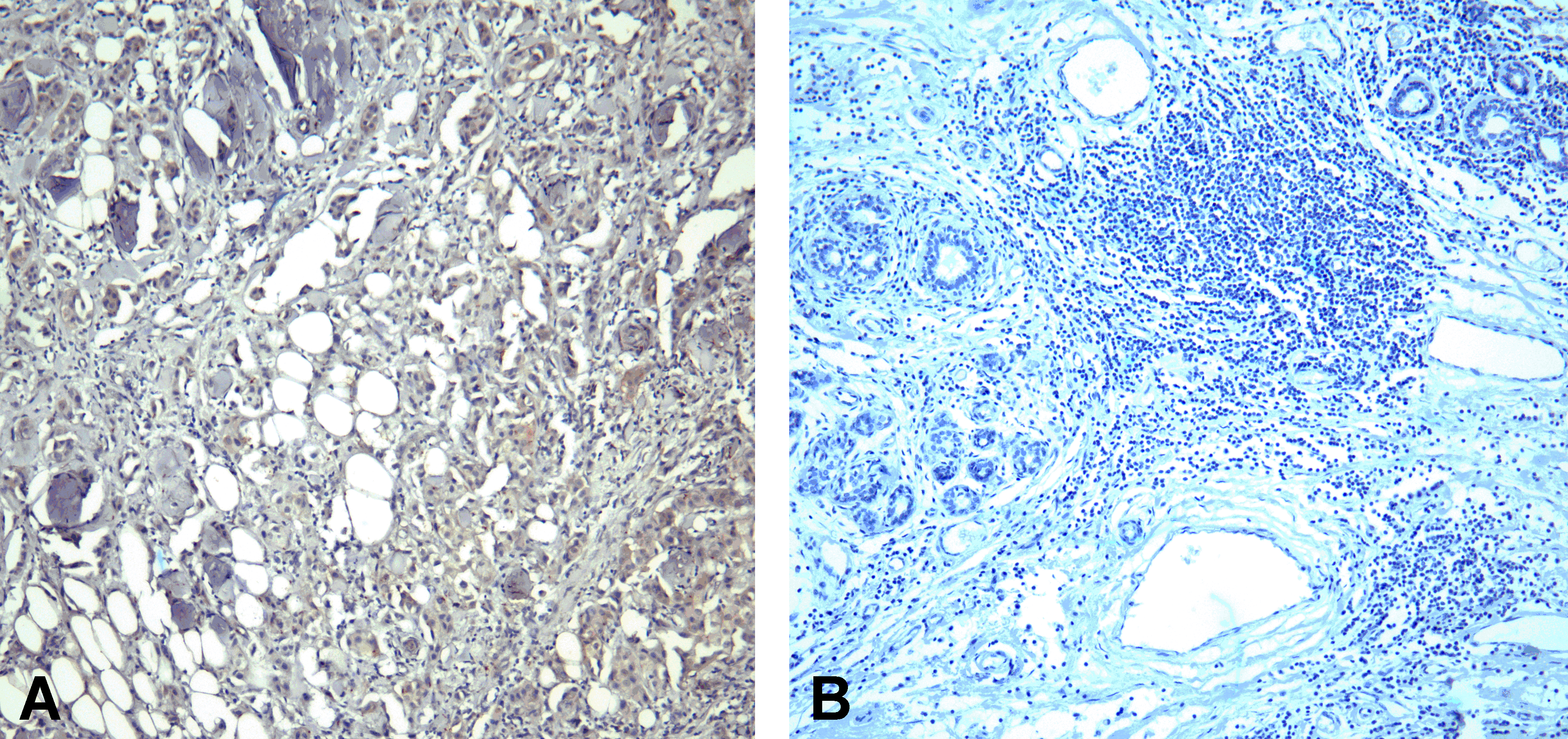PD1 Antibody [10B3]