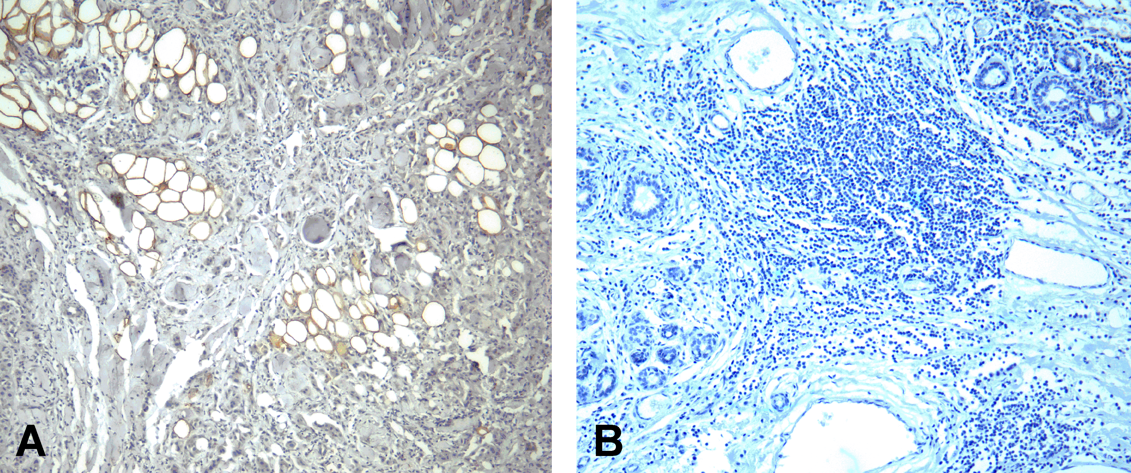 PD1 Antibody [4C7]