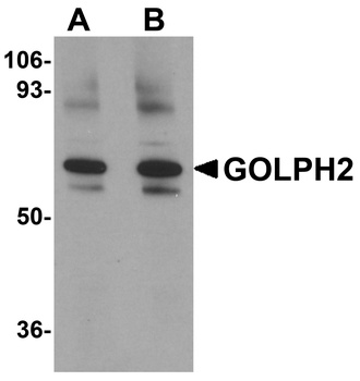GOLM1 Antibody