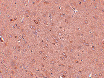 GOLM1 Antibody