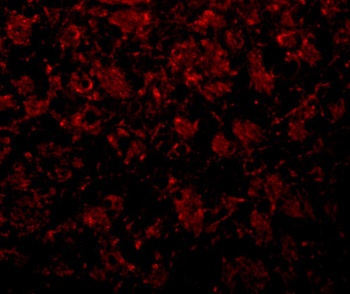 GOLM1 Antibody