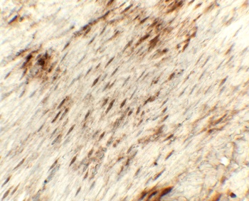 GOLGA1 Antibody