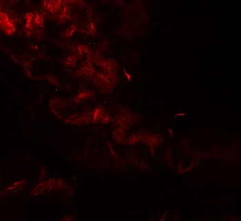 GOLGIN97 Antibody