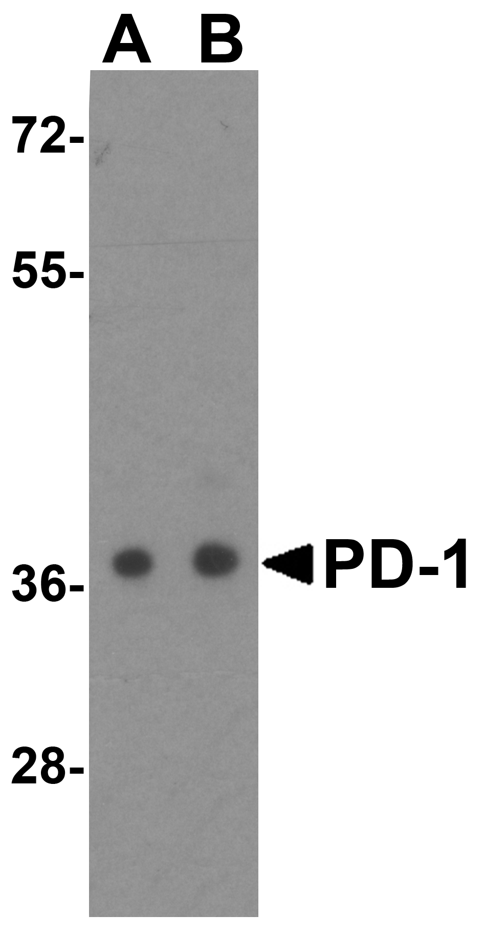 PDCD1 Antibody