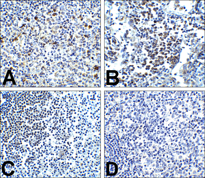 PDCD1 Antibody