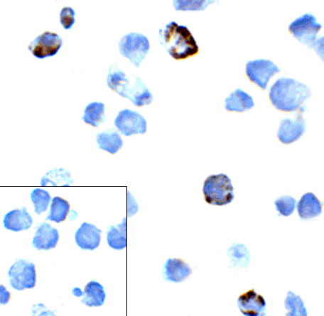 PDCD1 Antibody