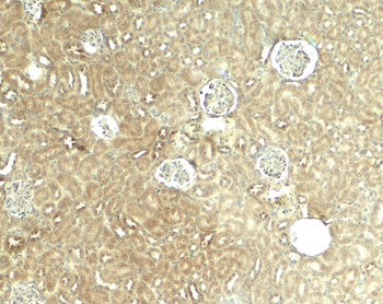 GLIS2 Antibody