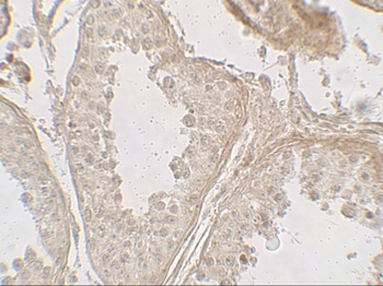 GLIPR1L2 Antibody
