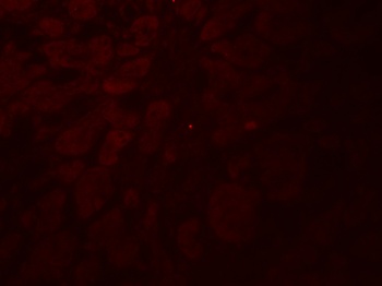 GLIPR1L2 Antibody