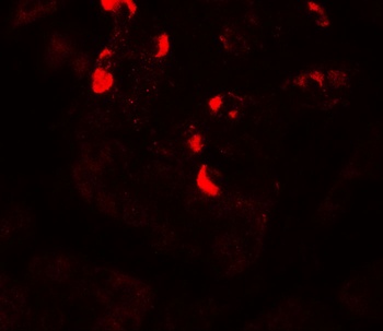 GLIPR1L1 Antibody