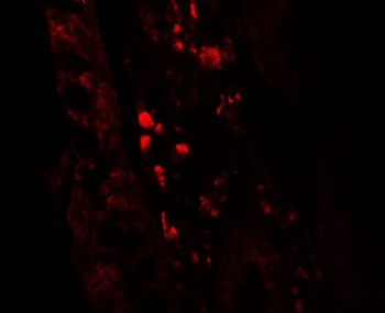 GLIPR1 Antibody
