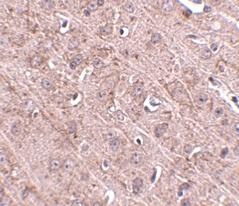 GLE1 Antibody