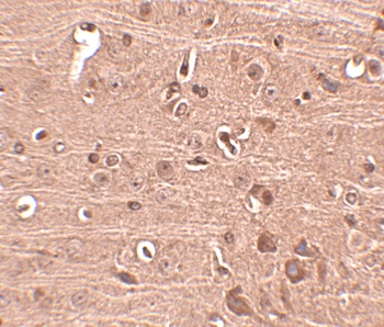 Gle1 Antibody