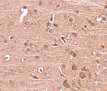 GLE1 Antibody