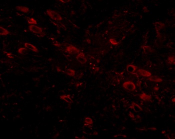 Gle1 Antibody