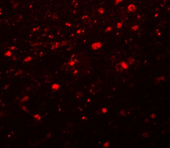 Girdin Antibody