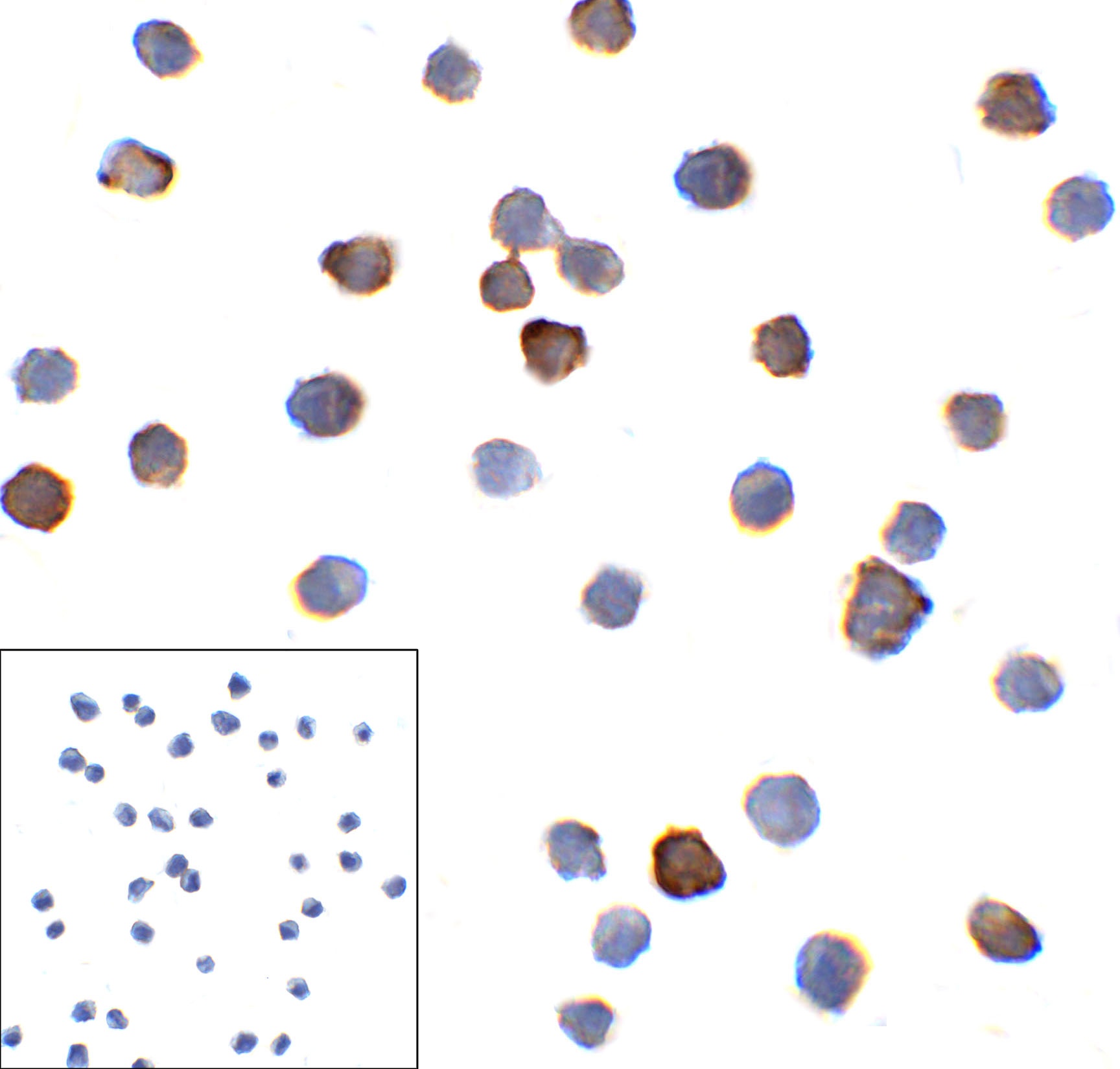 PDCD1 Antibody