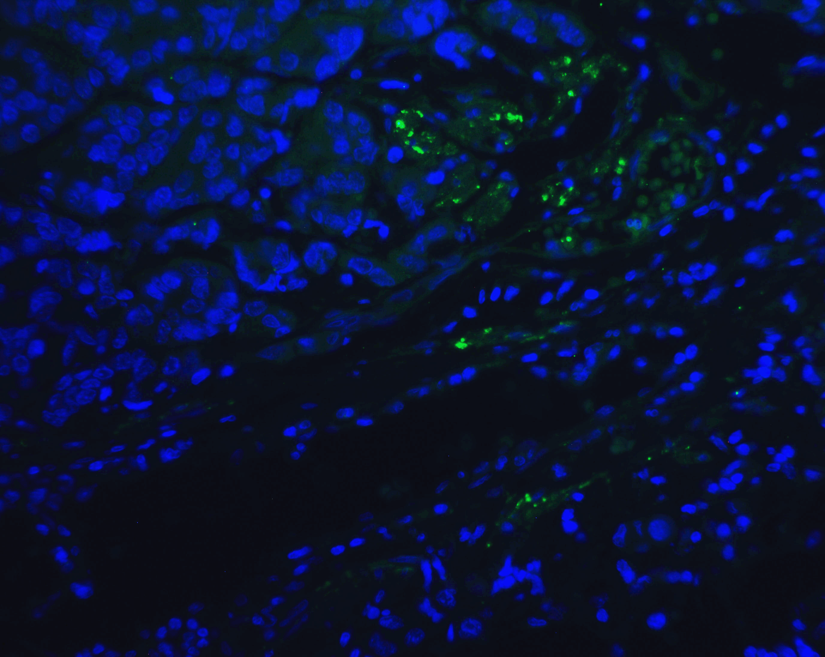 PDCD1 Antibody