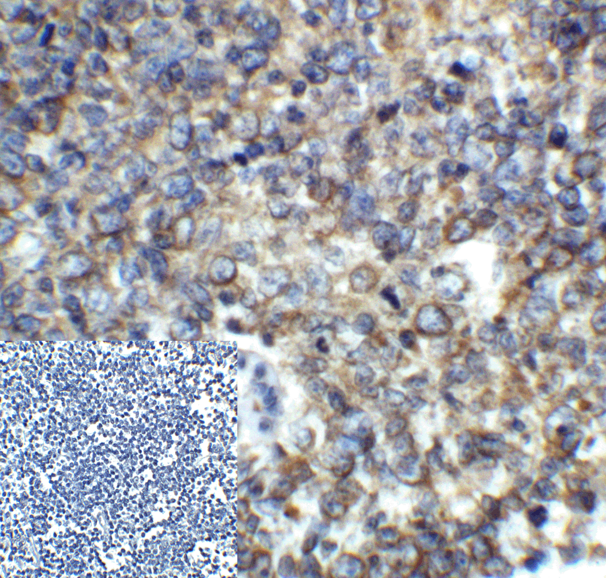 PDCD1 Antibody