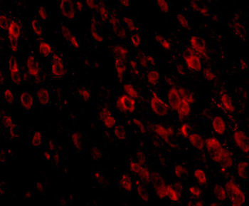 Pdcd1 Antibody