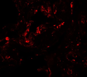 GDF1 Antibody