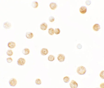 GBP6 Antibody