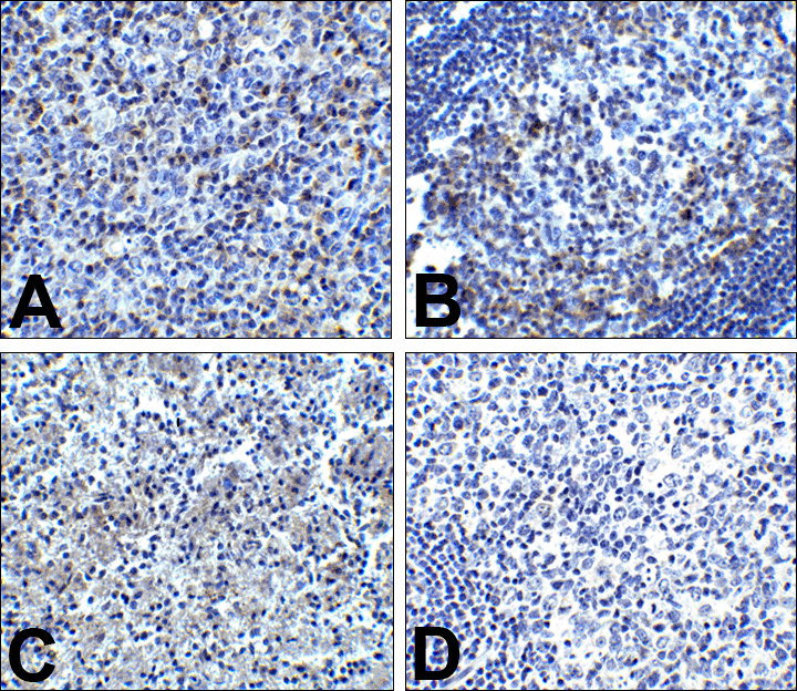 PDCD1 Antibody