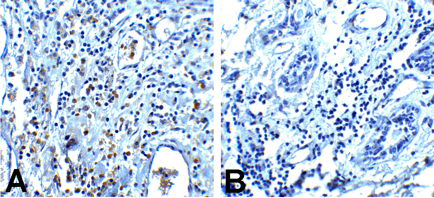 PDCD1 Antibody