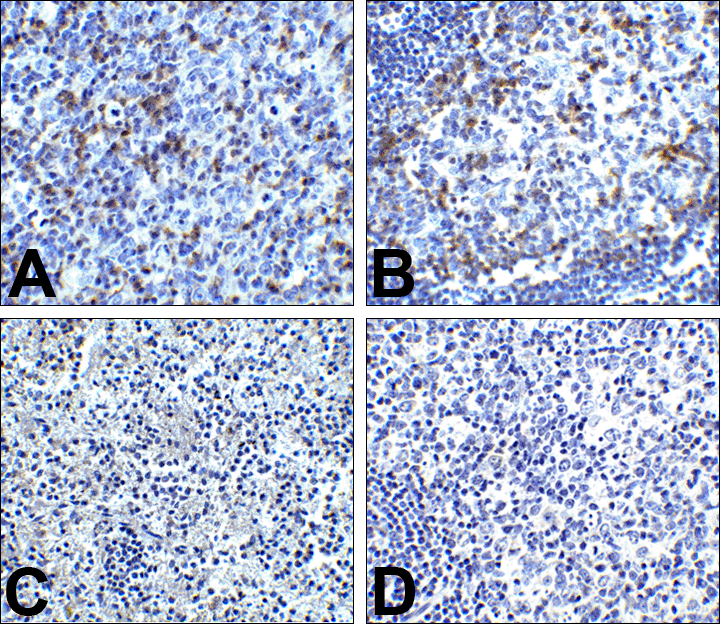 PDCD1 Antibody