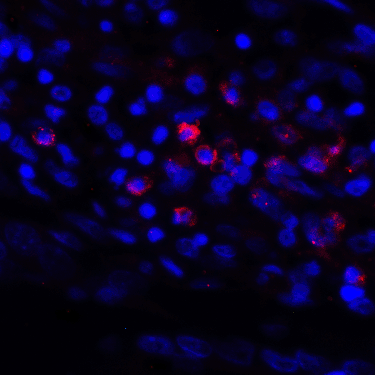 CD274 Antibody