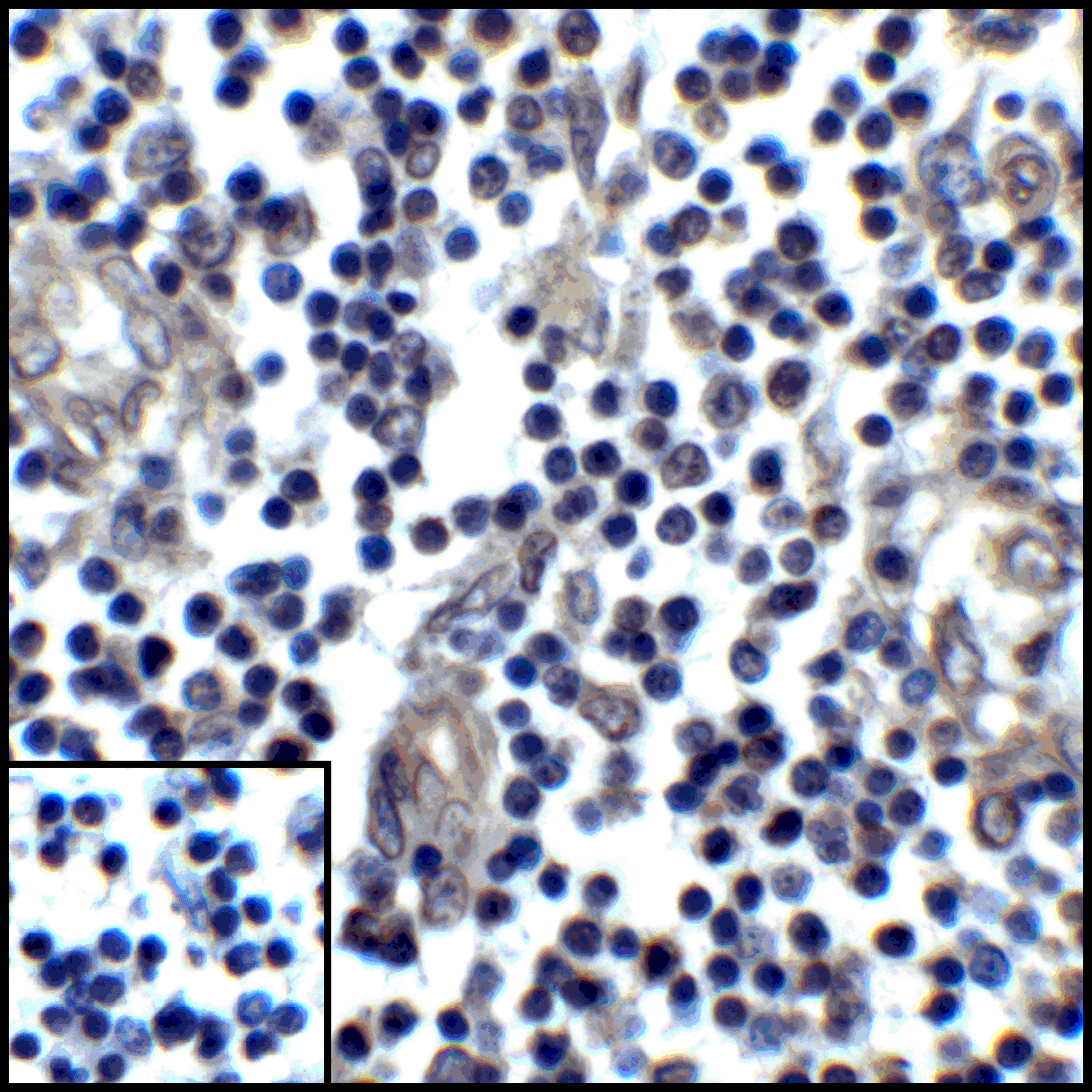 PDL1 Antibody [6H10]