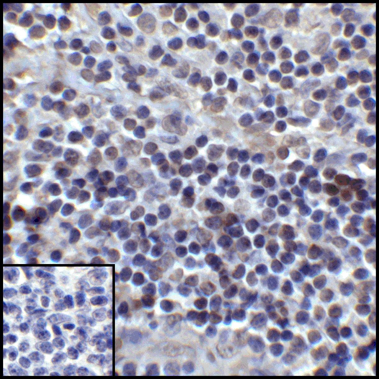 PDL1 Antibody [6H10]