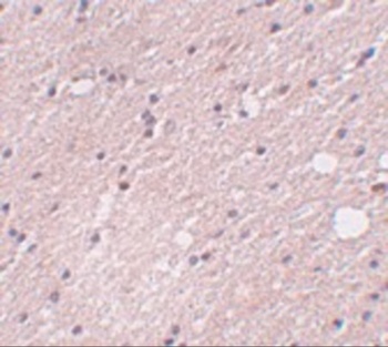 KIAA0195 Antibody