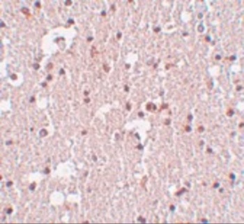 FRMPD3 Antibody