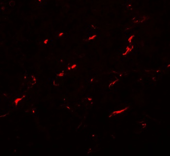 FMNL1 Antibody