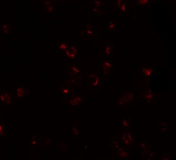 FREM2 Antibody