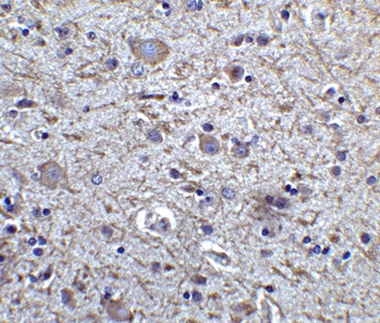 FOXP3 Antibody