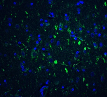 FOXP3 Antibody