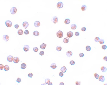 FOXO1 Antibody