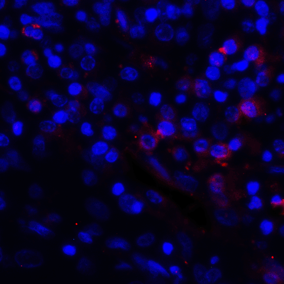 CD274 Antibody