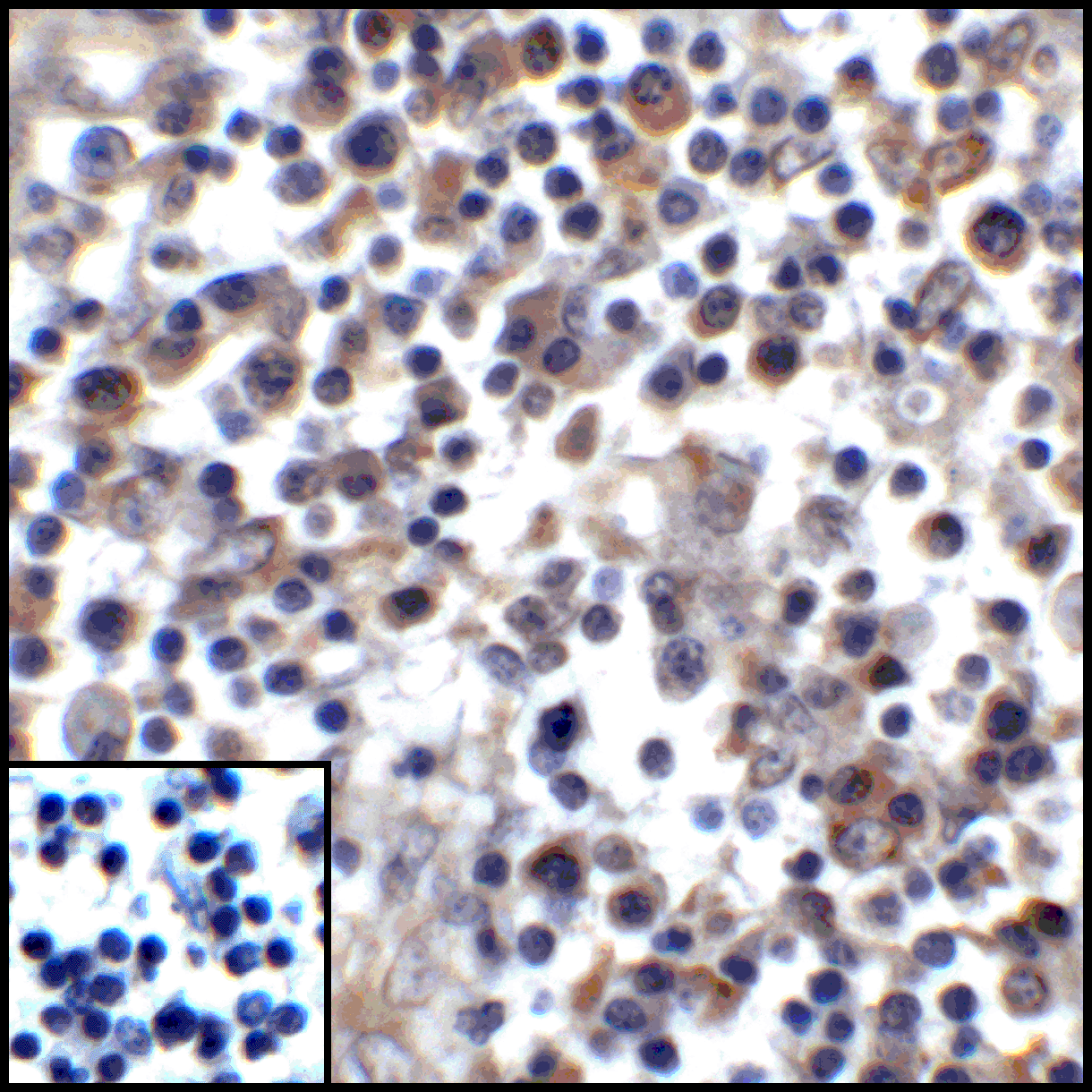 CD274 Antibody