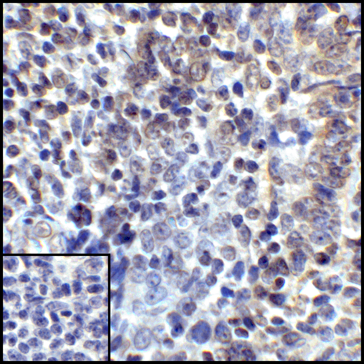 CD274 Antibody