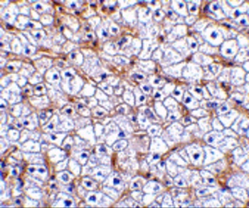 Fn14 Antibody