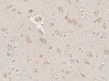 FMR1 Antibody